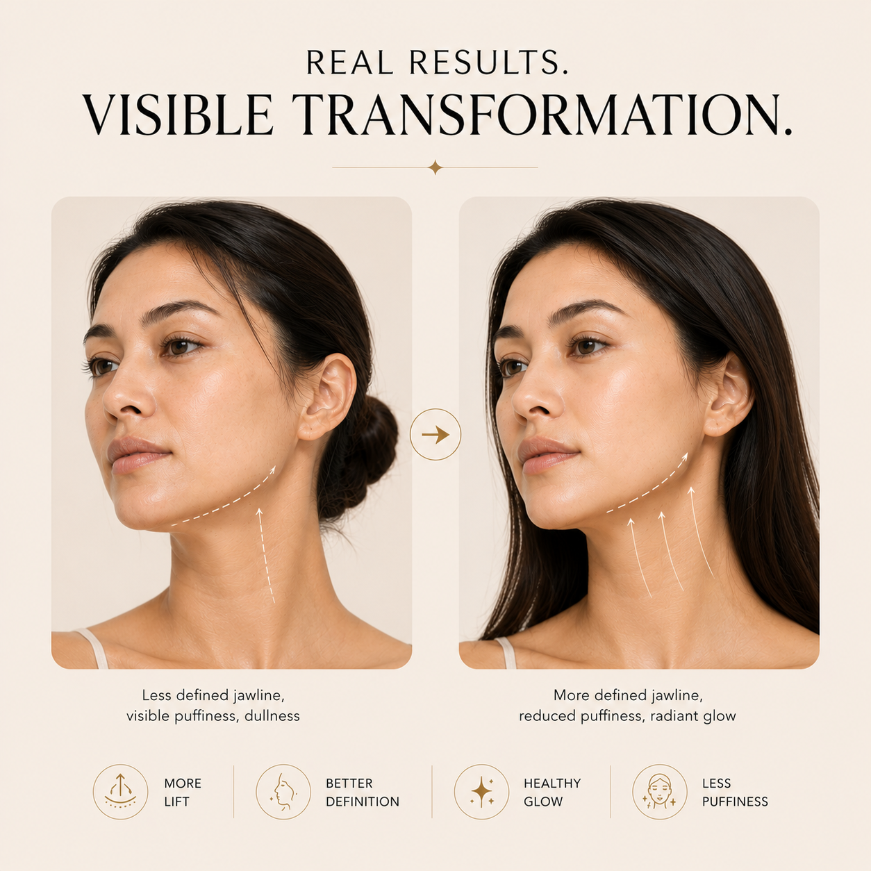 AuraLift™ – Advanced EMS Sculpting Massager